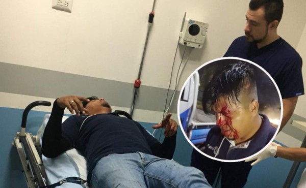 'Entre tres me patearon y agarraron del cuello': camarógrafo hondureño agredido por policías   