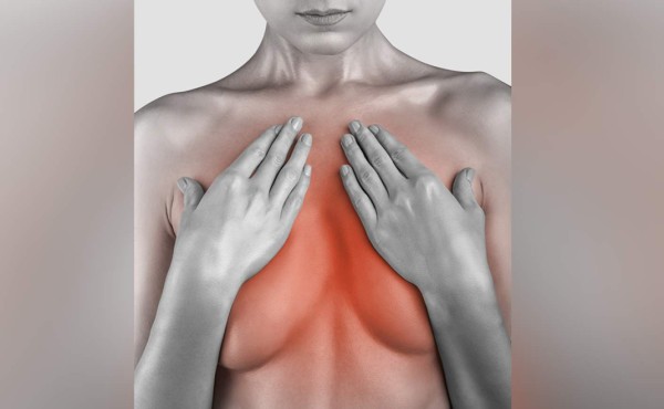 No le temas a la mamografía, puede salvar tu vida