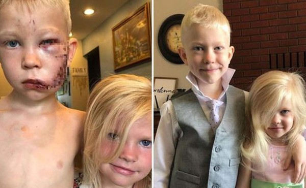 Historia viral: Niño salva a su hermanita de ser atacada por el perro del vecino