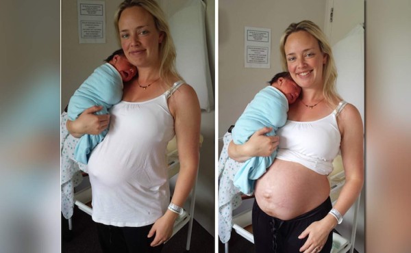 Muestra cómo queda el cuerpo de una mujer tras dar a luz