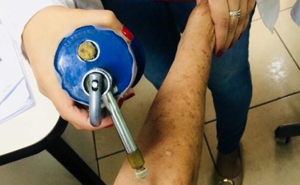 Detectan seis casos de cáncer en primer día de la Semana lunar en el Mario Rivas