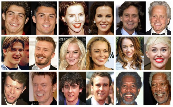 Dentaduras que cambiaron la sonrisas de los famosos