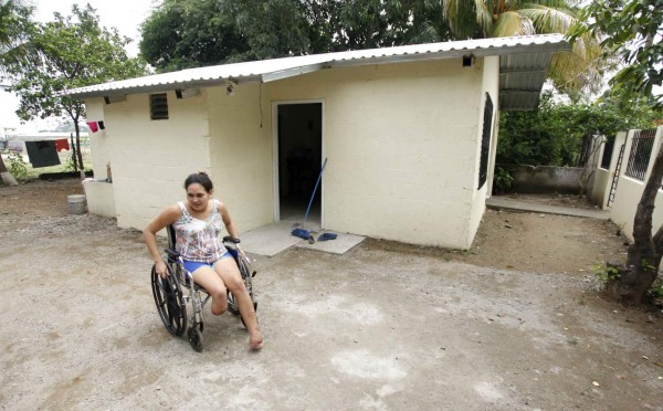 Mujer que marido le cortó los pies vuelve a la vida