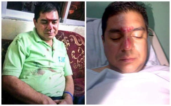 Director de Casa Alianza en Honduras denuncia supuesta golpiza por policías