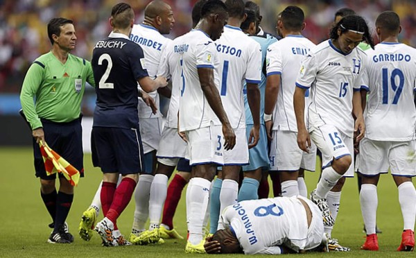 Juego duro de Honduras queda en entredicho tras partido ante Francia