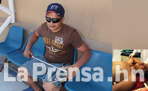 Emigra a ciegas hacia Estados Unidos por su seguridad