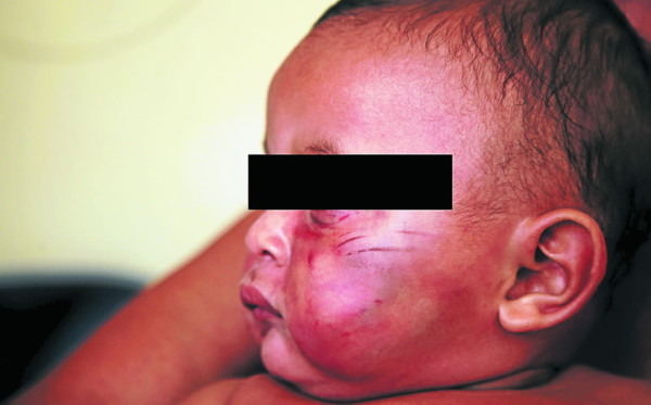 Envían a prisión a hondureño que maltrató a su hijo de seis meses