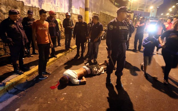 Un hincha herido tras el clásico Motagua-Olimpia