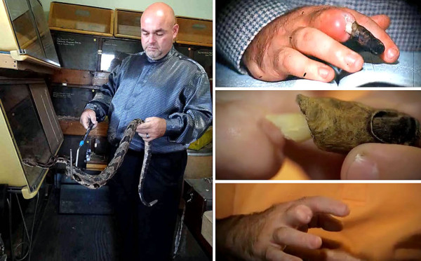 Muere pastor por no tratarse mordedura de serpiente