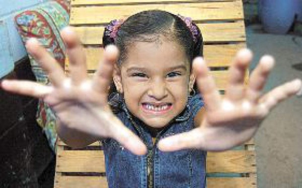 El estrés o la llegada de un hermano le afectan