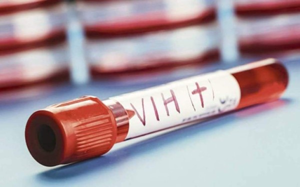 Juez bloquea despido de pilotos del ejército de EEUU portadores de VIH