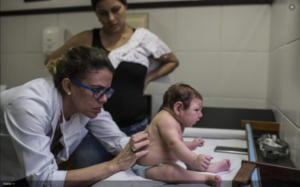 Salud: casos de Guillain-Barré ya se triplicaron