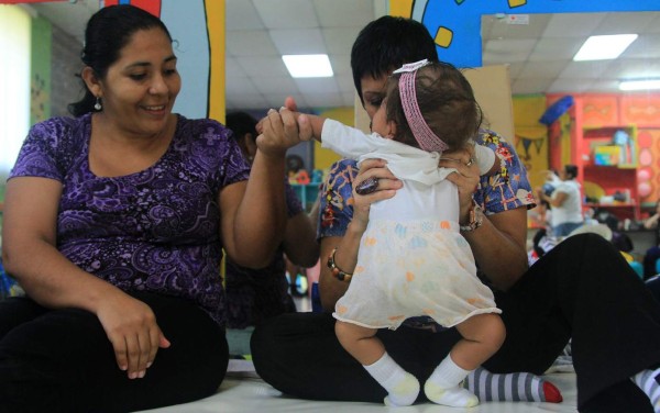 Más de 100 niños nacen con espina bífida al año en San Pedro Sula