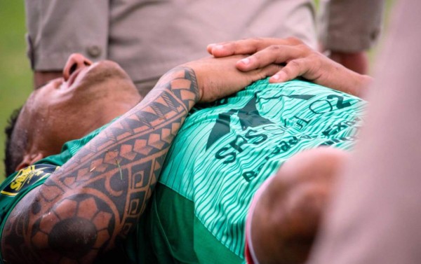 Luis Garrido sufre una fractura de costilla y sería baja por dos meses en el Marathón