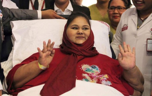 Muere la mujer más obesa del mundo tras bajar de peso