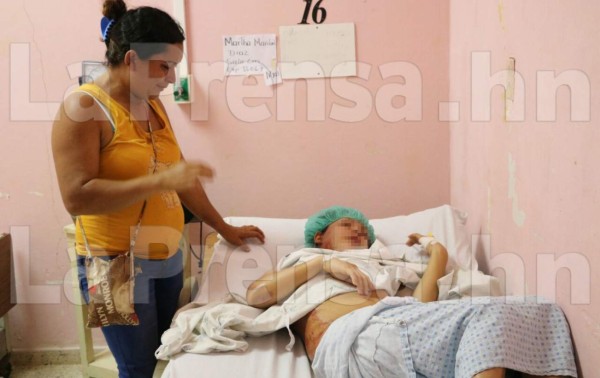 Hondureña quema con agua hirviendo a su cuñada en Santa Bárbara