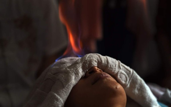 Los médicos que curan con fuego en China
