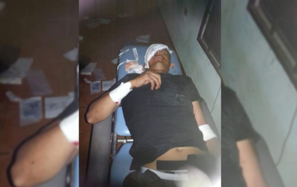 Tres navales resultaron heridos al enfrentarse con supuestos delincuentes