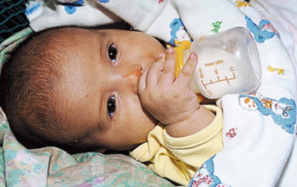 Las caries se producen por el biberón