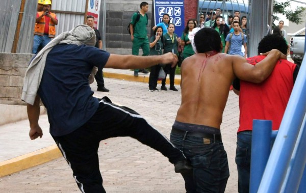 Salvajismo en la Unah agrava crisis de dos meses