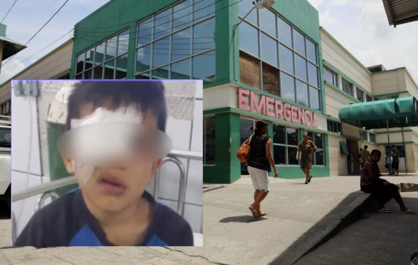 Copán: Niño pierde un ojo luego de que su compañero le lanzara un lápiz      