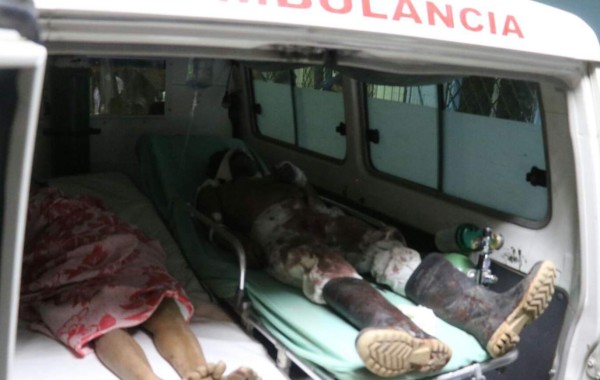 Madre e hijo son atacados a machetazos cuando dormían en su casa