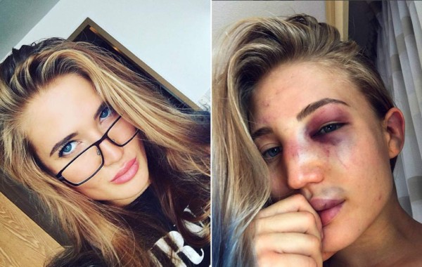 Rostro de bella luchadora quedó irreconocible tras combate