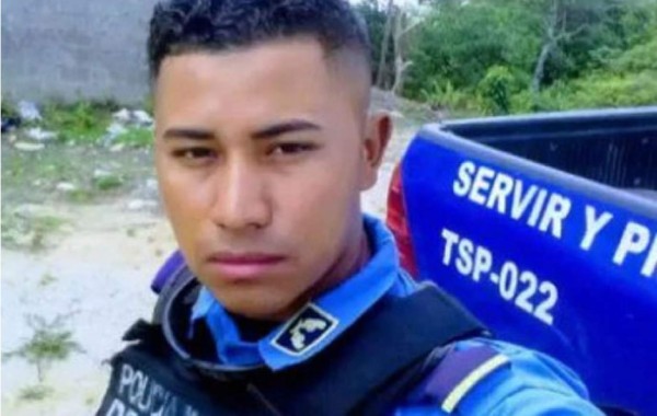 Muere policía que hace más de un mes sufrió quemaduras de tercer grado