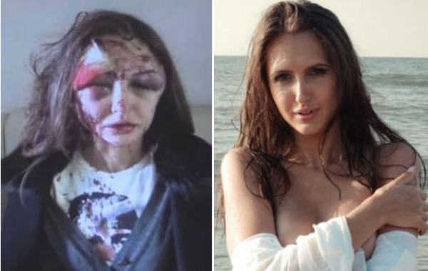 Millonario le dio brutal golpiza a su novia