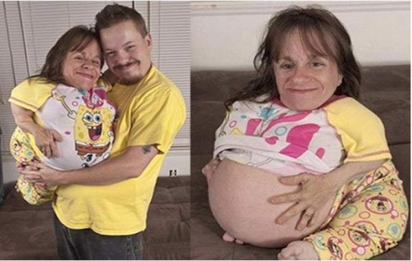 Los embarazos más sorprendentes del mundo