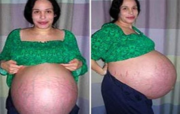 Los embarazos más sorprendentes del mundo