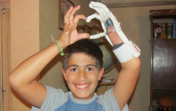Jóvenes argentinos fabrican mano para un niño con una impresora 3D