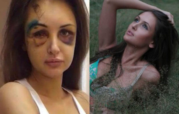 Millonario le dio brutal golpiza a su novia