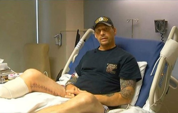 Crece temor por bacteria come carne en Estados Unidos