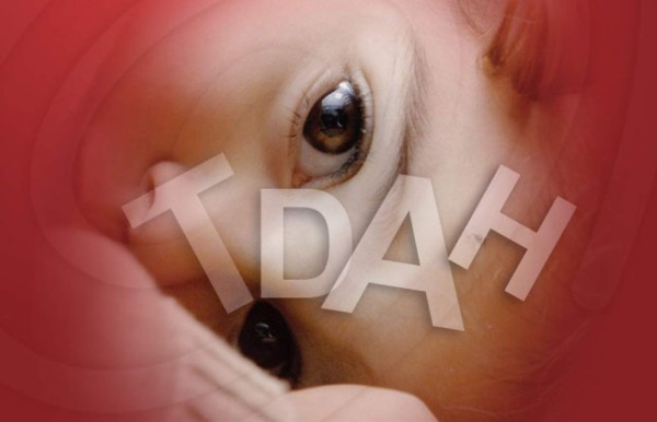 Niños prematuros tienen mayor riesgo de sufrir déficit de atención