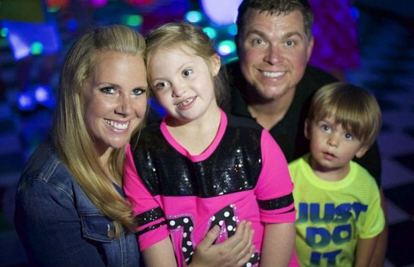 Hermosa modelo con síndrome de Down