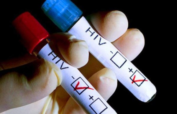 Hay más hombres que mujeres con VIH en Honduras