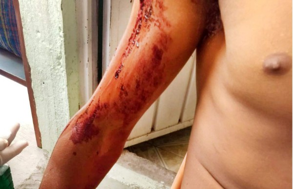 Policías atacan a tiros a migrantes hondureños en México