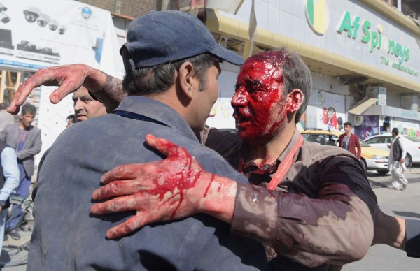 EDITORS NOTE: Graphic content / A wounded Afghan man receives assistance at the site of car bomb attack in Kabul on May 31, 2017.A massive blast rocked Kabul's diplomatic quarter during the morning rush hour on May 31, the latest attack to hit the Afghan capital. / AFP PHOTO / SHAH MARAI