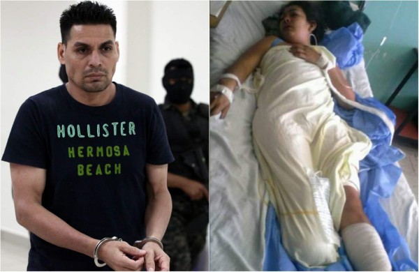 Más de 30 años de prisión por cortarle pies a su mujer