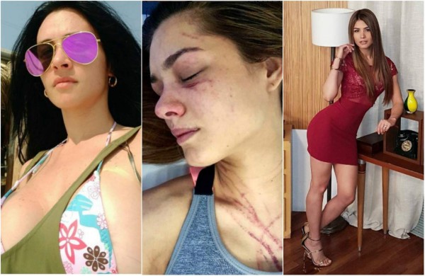 Diosa Canales ataca a mordidas a conductora de televisión