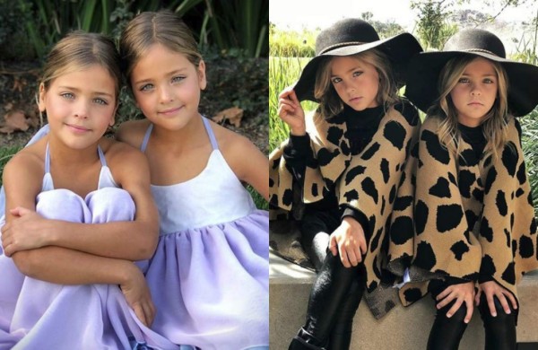 Las gemelas más bellas del mundo