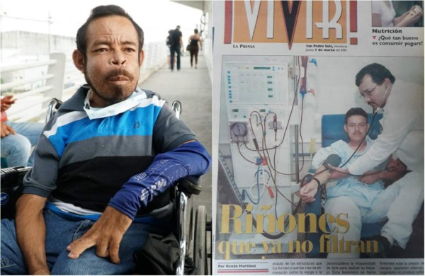 Marco supera la expectativa de vida de los enfermos renales