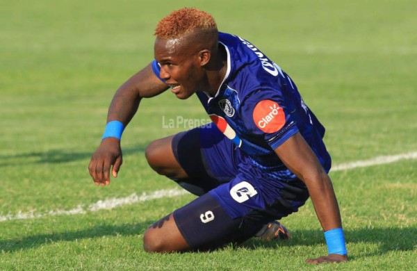 Rubilio no está lesionado; su problema es congénito