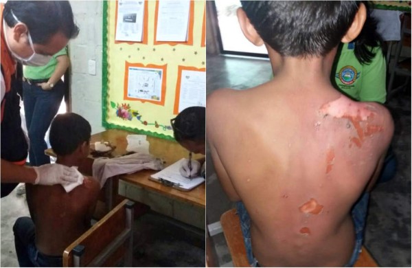 'Les tiré el agua porque estaba cansada”, expresó socióloga que quemó a niños