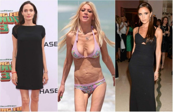 Famosas obsesionadas con el peso