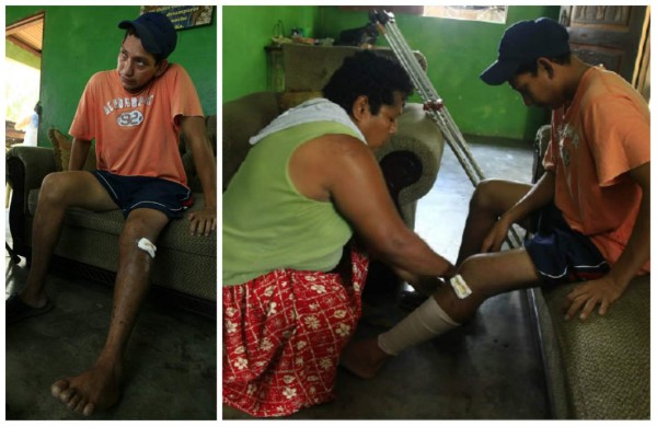 Así peleó un hondureño con un cocodrilo y vivió para contarlo