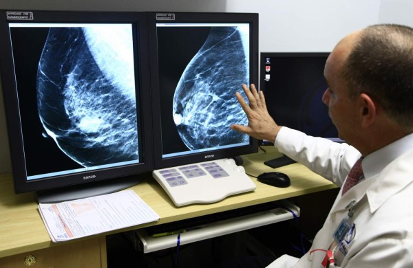 La mamografía en 3D es más clara