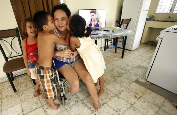 Mujer que marido le cortó los pies vuelve a la vida