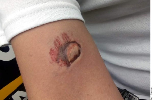 Supuesta ladrona propina una mordida a una policía cuando la arrestaba